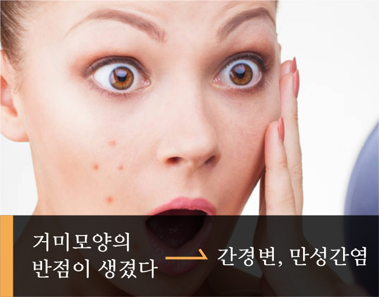 04_거미모양반점-03.jpg