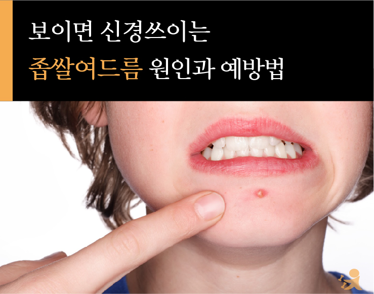 좁쌀여드름원인과예방법-01.jpg